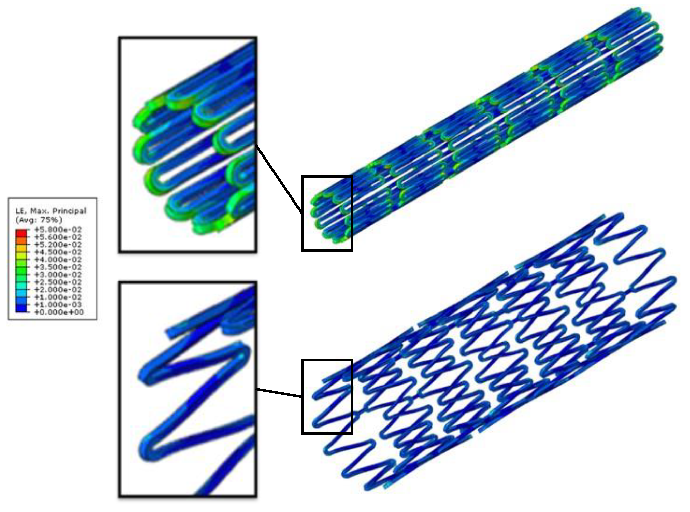 Nitinol Stent Fatigue Life Assessment